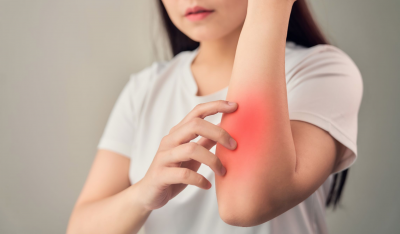 Mengenal Inflamasi dan Gejalanya